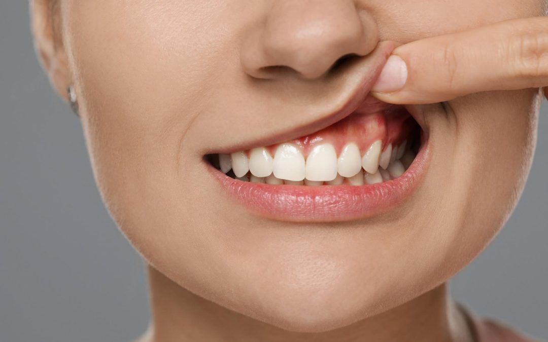 Can Teeth Cleaning Prevent Gum Disease? Understanding the Science of a Healthy Smile