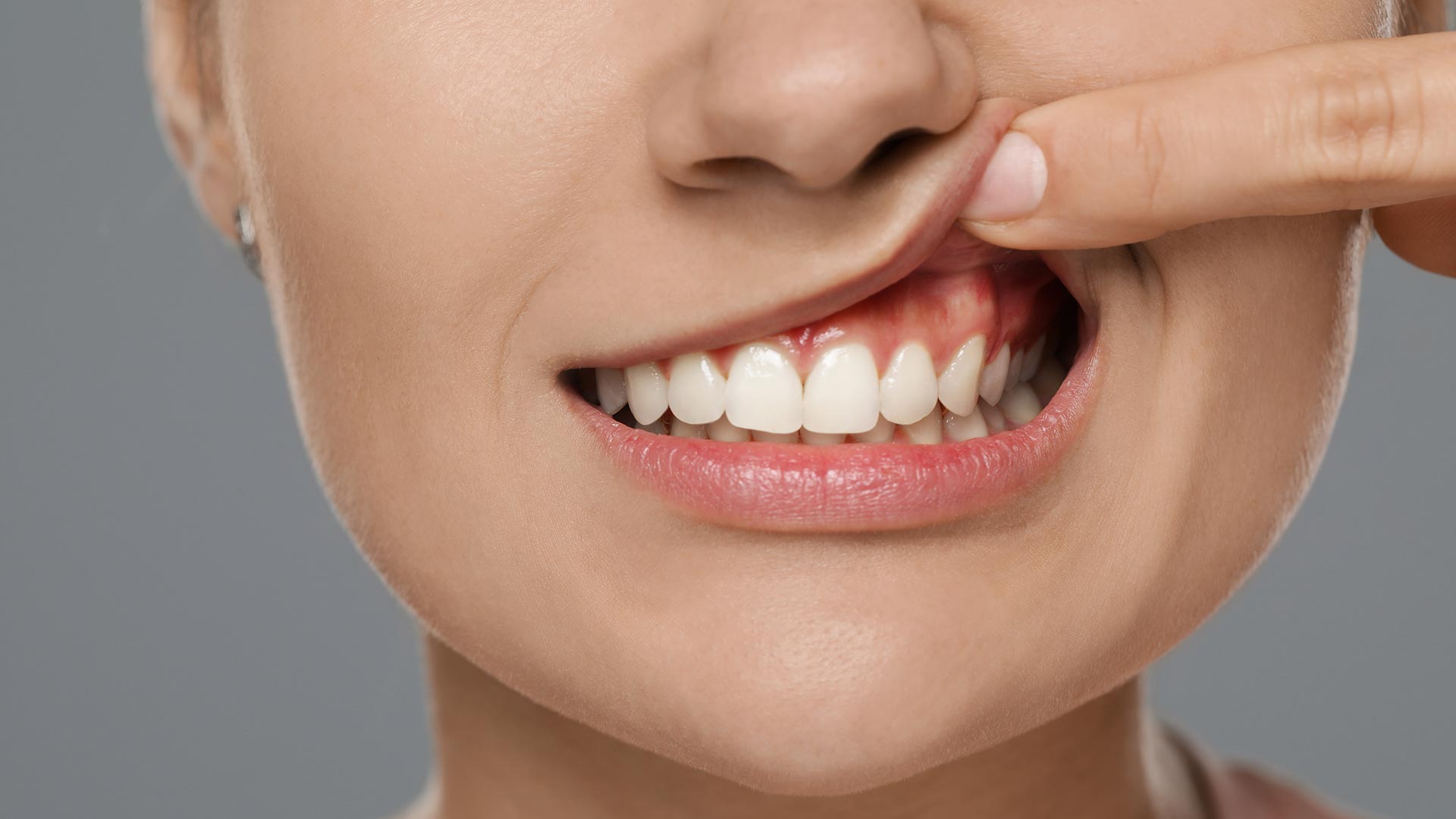 closeup of healthy white teeth with no gum disease thanks to regular dental cleanings