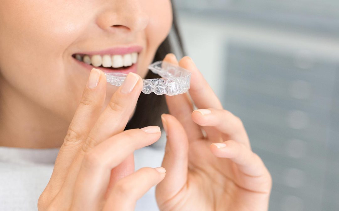 Can Invisalign Fix an Overbite?